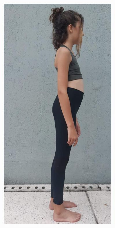 Antes &mdash; vista de perfil